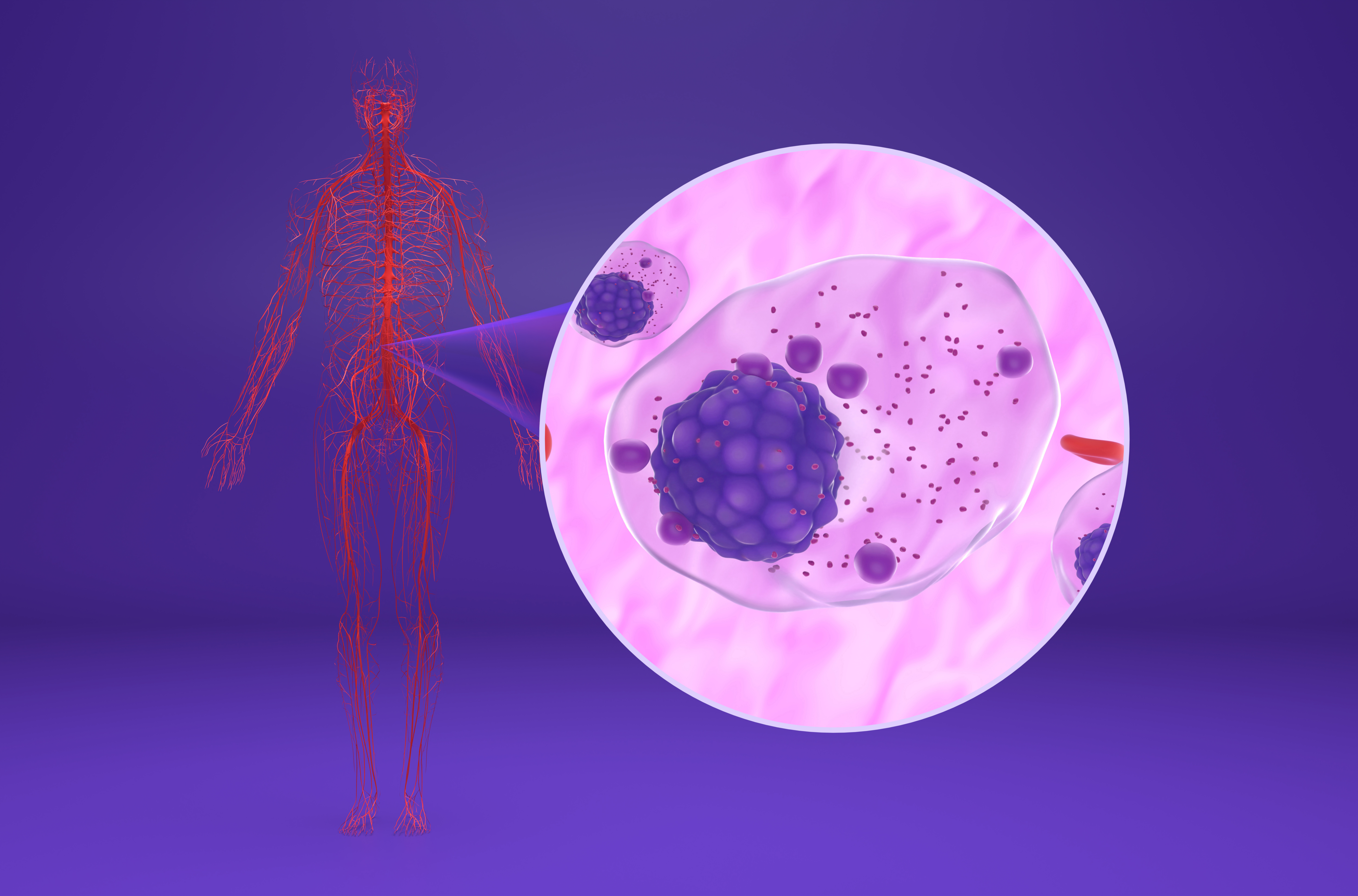Myeloma cell and model of human skeleton