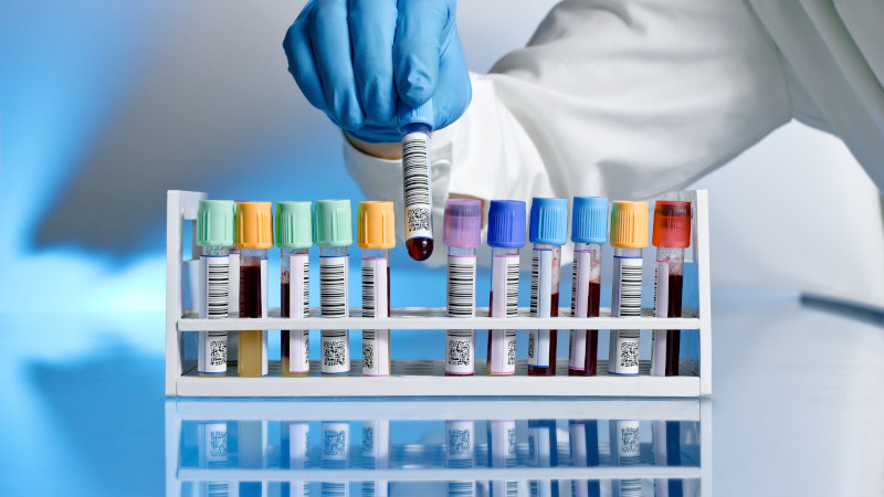 A row of vials of blood, labeled, gloved hand is picking one up
