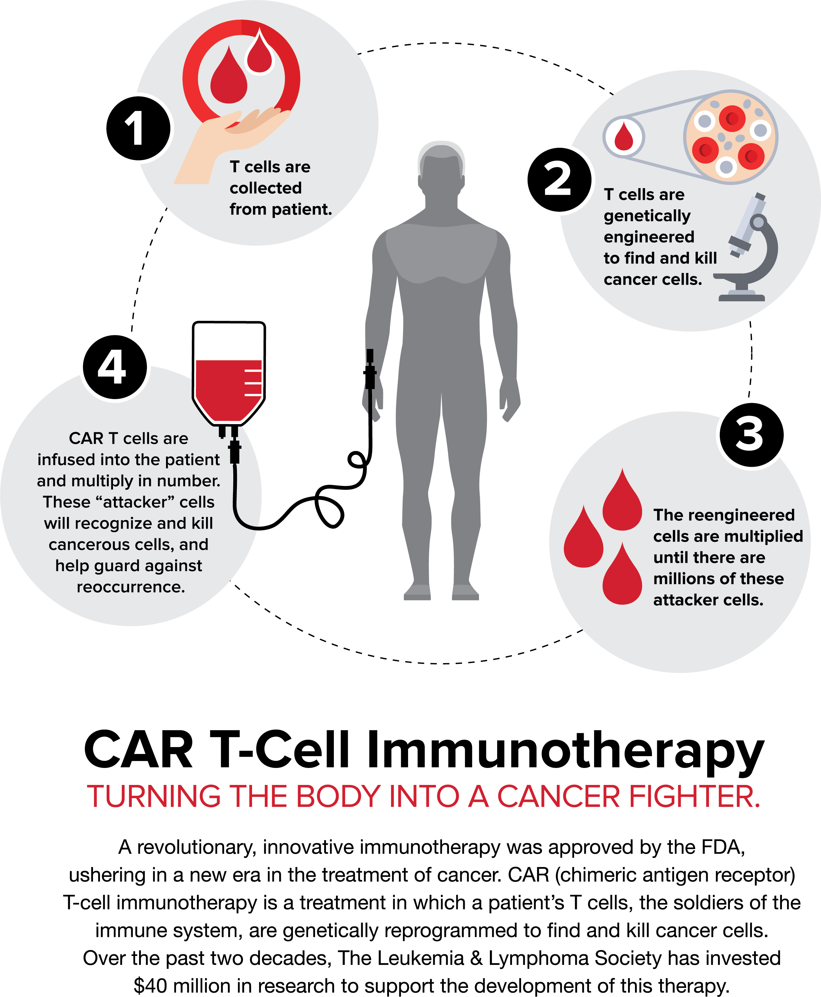 how fast can small cell lung cancer spread to the brain