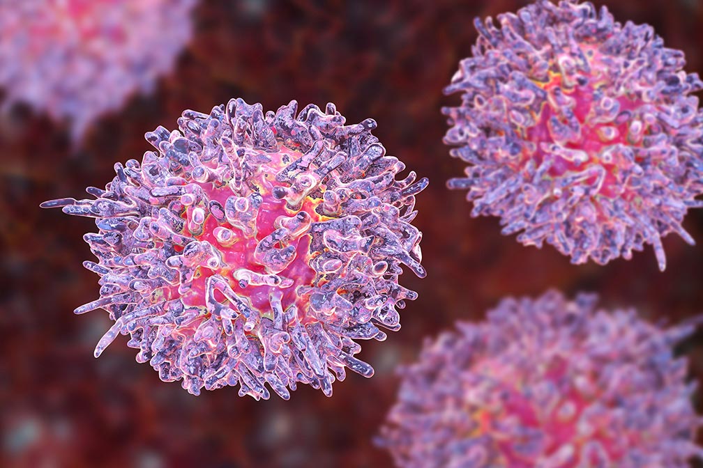 Leukemia Leukemia