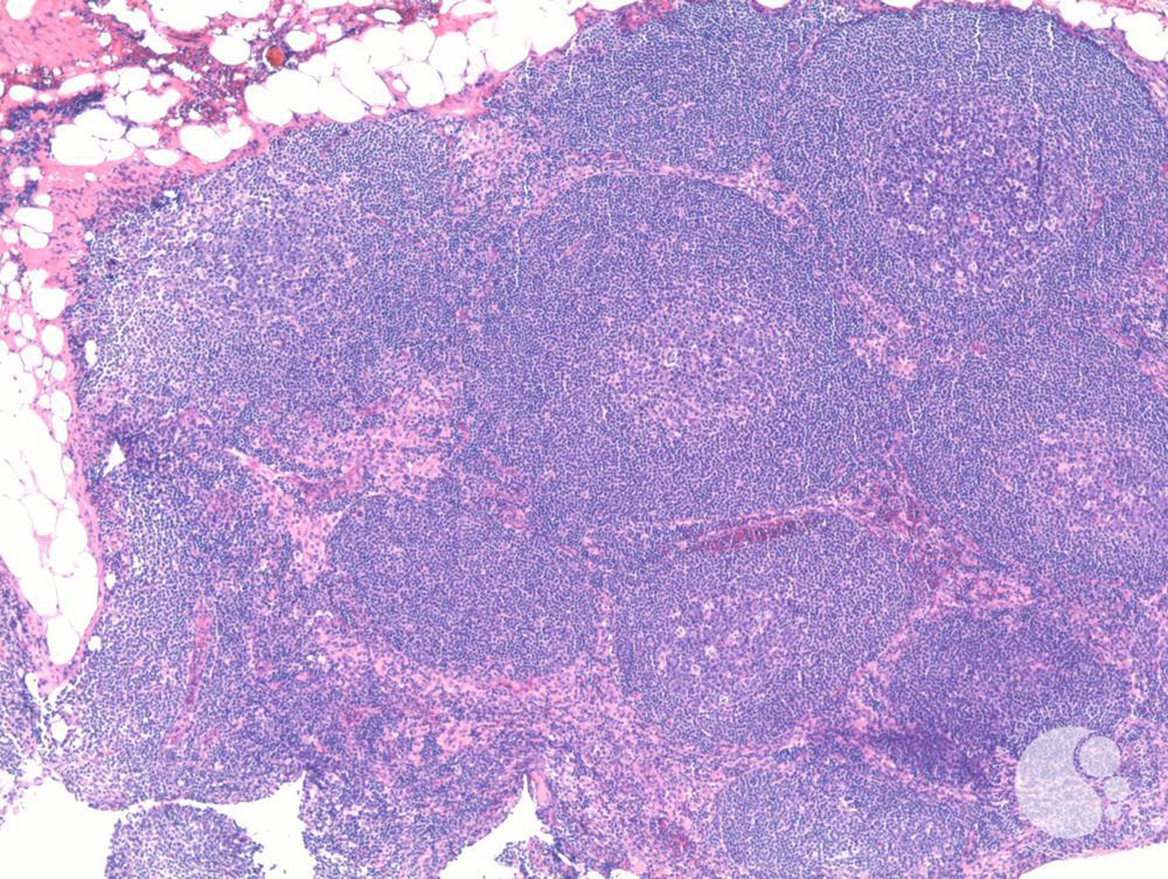 mantle cell