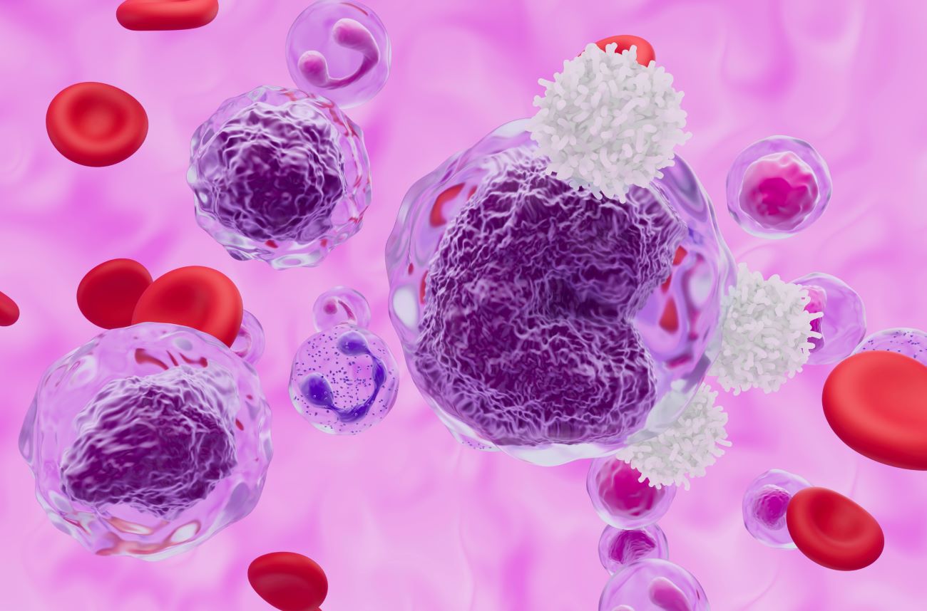Non-Hodgkin Lymphoma: Diagnosis, Treatment and Side Effect Management