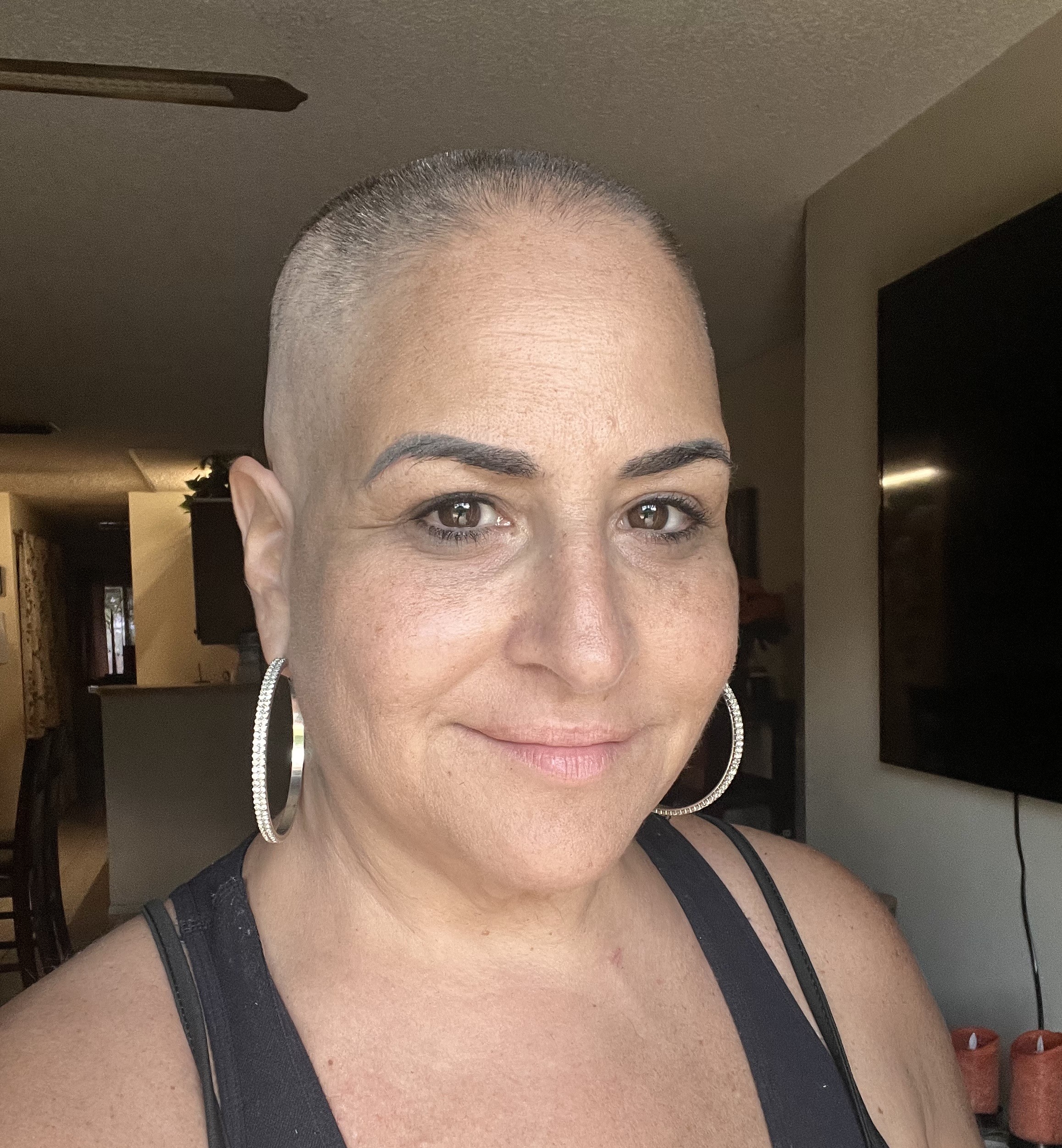 mantle cell lymphoma (MCL)