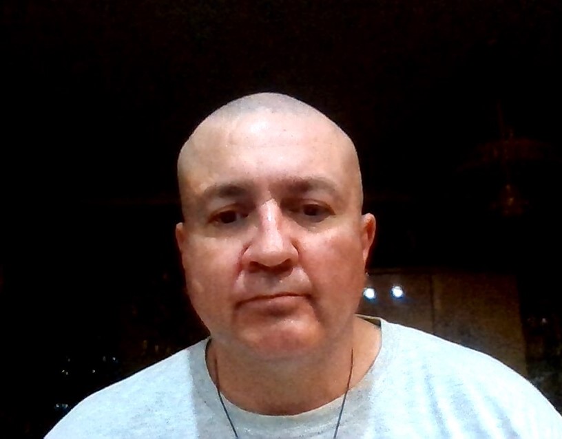 chronic myeloid leukemia (CML)