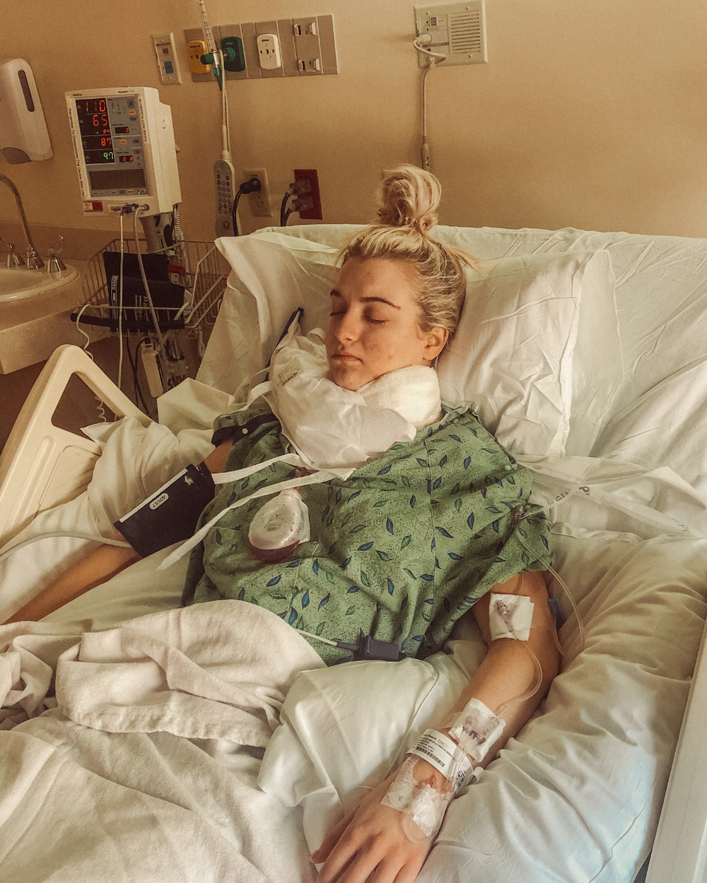 Brescia young white woman laying in a hospital bed with blond hair pulled into a pony tail on top of her head eyes closed wearing green leaf hospital gown