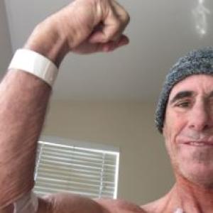 Mike mantle cell lymphoma