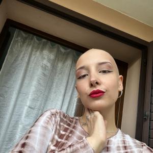 non-Hodgkin lymphoma (NHL)