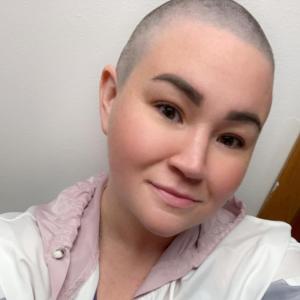 diffuse large B-cell lymphoma, woman, white, bald, purple top