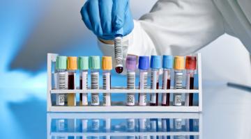 A row of vials of blood, labeled, gloved hand is picking one up