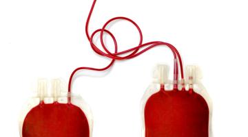 Hematopoietic Cell Transplantation as Treatment for Blood Cancers: The Team Approach
