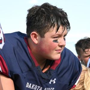 acute myeloid leukemia (AML) football