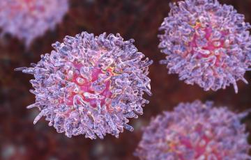Leukemia