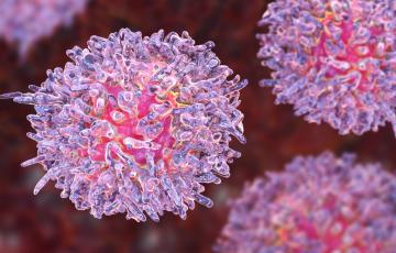 Microscopic image of leukemia cells