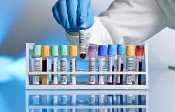 A row of vials of blood, labeled, gloved hand is picking one up