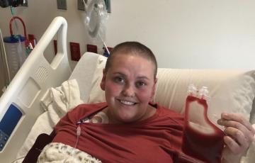 Laura stage IVB Hodgkin lymphoma