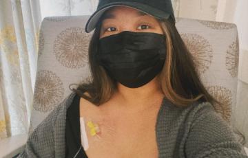 Hodgkin lymphoma Angelika