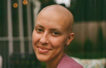 stage IV primary mediastinal B-cell Lymphoma (PMBL)