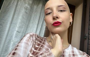 non-Hodgkin lymphoma (NHL)