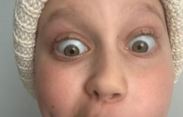 Hodgkin lymphoma (HL)