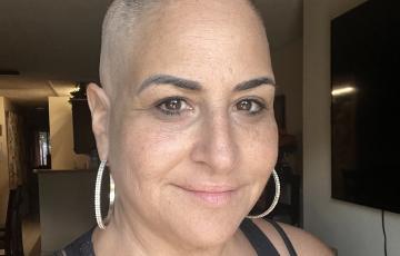 mantle cell lymphoma (MCL) 