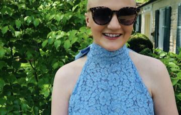 Bald white young lady wearing sunglasses and a blue top